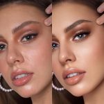 Removal of scars, pimples, blackheads